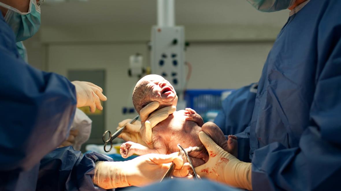 Actually, There’s No Way to Know if C-Sections Are Changing Humanity.